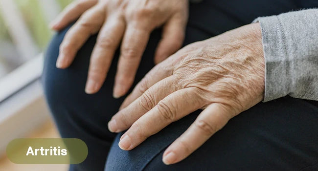 Estrategias naturales y efectivas para el alivio de la artritis